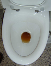 Toiletkumme. Der er vist ikke blevet skyllet ordentligt ud efter at der dagen forinden er blevet skoddet en cerut i kummen. (foto: D. Brønshøj)